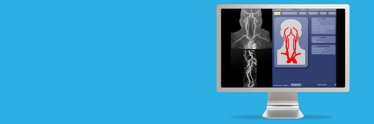 AngioCard Technologies